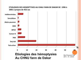 ETIOLOGIES DES HEMOPTYSIES AU CHNU FANN DE DAKAR DE 1996 à
    2001 à propos de 452 cas

Indéterminées

   Sarcoïdose

Abcès poumon

         DDB

        BPCO

     Cancer B

         PAB

      Seq tub

   Tub active
                                                                              %
                0    10       20        30       40        50            60

            Etiologies des hémoptysies                    Rev Pneumol Trop
                                                          2011 ; 15 : 20-30
            Au CHNU fann de Dakar
 