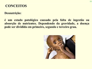 10
CONCEITOS
Desnutrição:
é um estado patológico causado pela falta de ingestão ou
absorção de nutrientes. Dependendo da gravidade, a doença
pode ser dividida em primeiro, segundo e terceiro grau.
 
