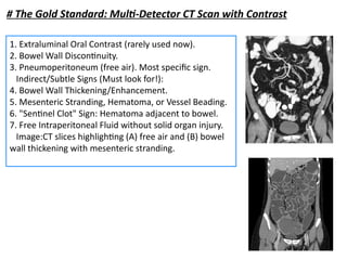 Small Intestine Injury Small Intestine Trauma for surgery.......pptx