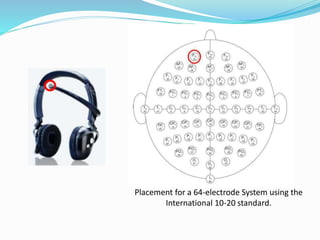 Placement for a 64-electrode System using the
International 10-20 standard.
 