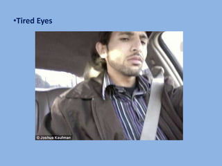 •Tired Eyes
 
