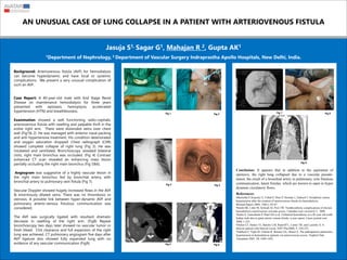 AN UNUSUAL CASE OF LUNG COLLAPSE IN A PATIENT WITH ARTERIOVENOUS FISTULA
Jasuja S1, Sagar G1, Mahajan R 2, Gupta AK1
1Department of Nephrology, 2 Department of Vascular Surgery Indraprastha Apollo Hospitals, New Delhi, India.
Background: Arteriovenous fistula (AVF) for hemodialysis
can become hyperdynamic and have local or systemic
complications. We present a very unusual complication of
such an AVF.
Case Report: A 40-year-old male with End Stage Renal
Disease on maintenance hemodialysis for three years
presented with epistaxis, hemoptysis, accelerated
hypertension (HTN) and breathlessness.
Examination showed a well functioning radio-cephalic
arteriovenous fistula with swelling and palpable thrill in the
entire right arm. There were distended veins over chest
wall (Fig1& 2). He was managed with anterior nasal packing
and anti-hypertensive treatment. His condition deteriorated
and oxygen saturation dropped. Chest radiograph (CXR)
showed complete collapse of right lung (Fig 3). He was
intubated and ventilated. Bronchoscopy revealed bilateral
clots; right main bronchus was occluded. (Fig 4) Contrast
enhanced CT scan revealed an enhancing mass lesion
partially occluding the right main bronchus (Fig 5&6).
Angiogram was suggestive of a highly vascular lesion in
the right main bronchus fed by bronchial artery, with
bronchial artery to pulmonary vein fistula (Fig 7).
Vascular Doppler showed hugely increased flows in the AVF
& enormously dilated veins. There was no thrombosis or
stenosis. A possible link between hyper-dynamic AVF and
pulmonary arterio-venous fistulous communication was
considered.
The AVF was surgically ligated with resultant dramatic
decrease in swelling of the right arm. (Fig8) Repeat
bronchoscopy two days later showed no vascular tumor or
fresh bleed. Clot clearance and full expansion of the right
lung was achieved. CT pulmonary angiogram five days after
AVF ligature also showed fully expanded lung with no
evidence of any vascular communication (Fig9).
Conclusion: It appears that in addition to the aspiration of
epistaxis, the right lung collapsed due to a vascular pseudo-
tumor, the result of a bronchial artery to pulmonary vein fistulous
communication, latent fistulas, which are known to open in hyper
dynamic circulatory flows.
Fig 1
References:
•Bachelda P, Kojecky Z, Utikal P, Drac P, Herman J, Zadrazil J. Peripheral venous
hypertension after the creation of arteriovenous fistula for hemodialysis.
Biomed.Papers 2004, 148(1), 85-87
•Smith SR, Little M, Schwab SJ, Post TW. Nonthrombotic complications of chronic
hemodialysis arteriovenous vascular access. Uptodate.com version16.3, 2008
•Salim S, Ganeshram P, Patel AD et al. Unilateral hemothorax in a 46 year old south
Indian male due to giant arterio venous fistula: a case report. Cases journal.com
2008, 1:225
•Diskin CJ, Stokes TJ, Dansby LM, Radcliff L, Carter TB, and Lazenby A. A
dialysis patient with blurred vision. NDT Plus2008; 4: 250-252.
•Nakhoul F, Yigla M, Gilman R, Reisner SA, Abassi Z, The pathogenesis pulmonary
hypertension in hemodialysis patients via arteriovenous access. Nephrol Dial
Transplant 2005; 20; 1686-1692.
Fig 2
Fig 3 Fig 4
Fig 5 Fig 6
Fig 7 Fig 8
Fig 9
 