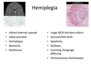 Hemiplegia



•   Infarct internal capsule   • Large MCA territory infarct
•   Likely prenatal            • Seizures/HIE birth
•   Hemiplegia                 • Spasticity
•   Spasticity                 • Epilepsy
•   Dyskinesia                 • Learning /language
                                 difficulty
                               • Homonymous Hemianopia
 