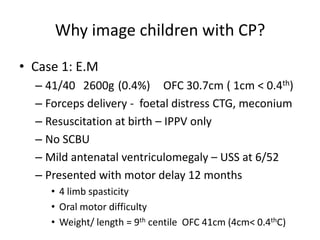 Why image children with CP?
• Case 1: E.M
  – 41/40 2600g (0.4%) OFC 30.7cm ( 1cm < 0.4th)
  – Forceps delivery - foetal distress CTG, meconium
  – Resuscitation at birth – IPPV only
  – No SCBU
  – Mild antenatal ventriculomegaly – USS at 6/52
  – Presented with motor delay 12 months
     • 4 limb spasticity
     • Oral motor difficulty
     • Weight/ length = 9th centile OFC 41cm (4cm< 0.4thC)
 