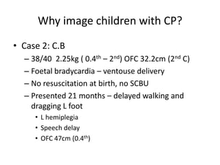 Why image children with CP?
• Case 2: C.B
  – 38/40 2.25kg ( 0.4th – 2nd) OFC 32.2cm (2nd C)
  – Foetal bradycardia – ventouse delivery
  – No resuscitation at birth, no SCBU
  – Presented 21 months – delayed walking and
    dragging L foot
     • L hemiplegia
     • Speech delay
     • OFC 47cm (0.4th)
 