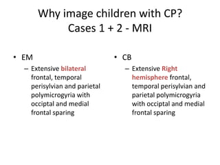 Why image children with CP?
            Cases 1 + 2 - MRI

• EM                           • CB
  – Extensive bilateral          – Extensive Right
    frontal, temporal              hemisphere frontal,
    perisylvian and parietal       temporal perisylvian and
    polymicrogyria with            parietal polymicrogyria
    occiptal and medial            with occiptal and medial
    frontal sparing                frontal sparing
 