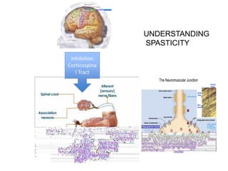 UNDERSTANDING
               SPASTICITY
 Inhibition
Corticospina
   l Tract
 