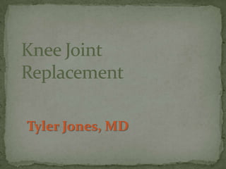 Knee JointReplacement Tyler Jones, MD 