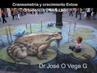 Dr José O Vega G
Craneometría y crecimiento Enlow
Ortodoncia UNAN-León
 