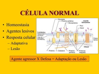 CÉLULA NORMAL
• Homeostasia
• Agentes lesivos
• Resposta celular
– Adaptativa
– Lesão
Agente agressor X Defesa = Adaptação ou Lesão
 