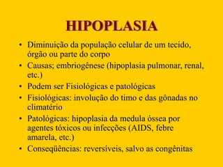 HIPOPLASIA
• Diminuição da população celular de um tecido,
órgão ou parte do corpo
• Causas; embriogênese (hipoplasia pulmonar, renal,
etc.)
• Podem ser Fisiológicas e patológicas
• Fisiológicas: involução do timo e das gônadas no
climatério
• Patológicas: hipoplasia da medula óssea por
agentes tóxicos ou infecções (AIDS, febre
amarela, etc.)
• Conseqüências: reversíveis, salvo as congênitas
 