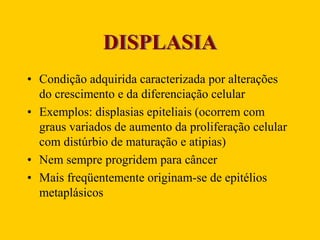 DISPLASIA
• Condição adquirida caracterizada por alterações
do crescimento e da diferenciação celular
• Exemplos: displasias epiteliais (ocorrem com
graus variados de aumento da proliferação celular
com distúrbio de maturação e atipias)
• Nem sempre progridem para câncer
• Mais freqüentemente originam-se de epitélios
metaplásicos
 
