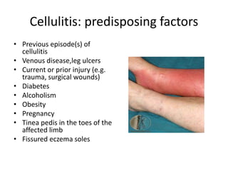 SKIN INFECTIONS WITH MANAGMENT | PPT