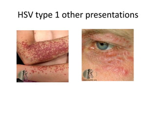 SKIN INFECTIONS WITH MANAGMENT | PPT