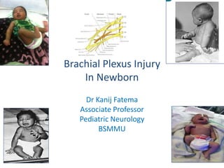 Brachial Plexus Injury
In Newborn
Dr Kanij Fatema
Associate Professor
Pediatric Neurology
BSMMU
 
