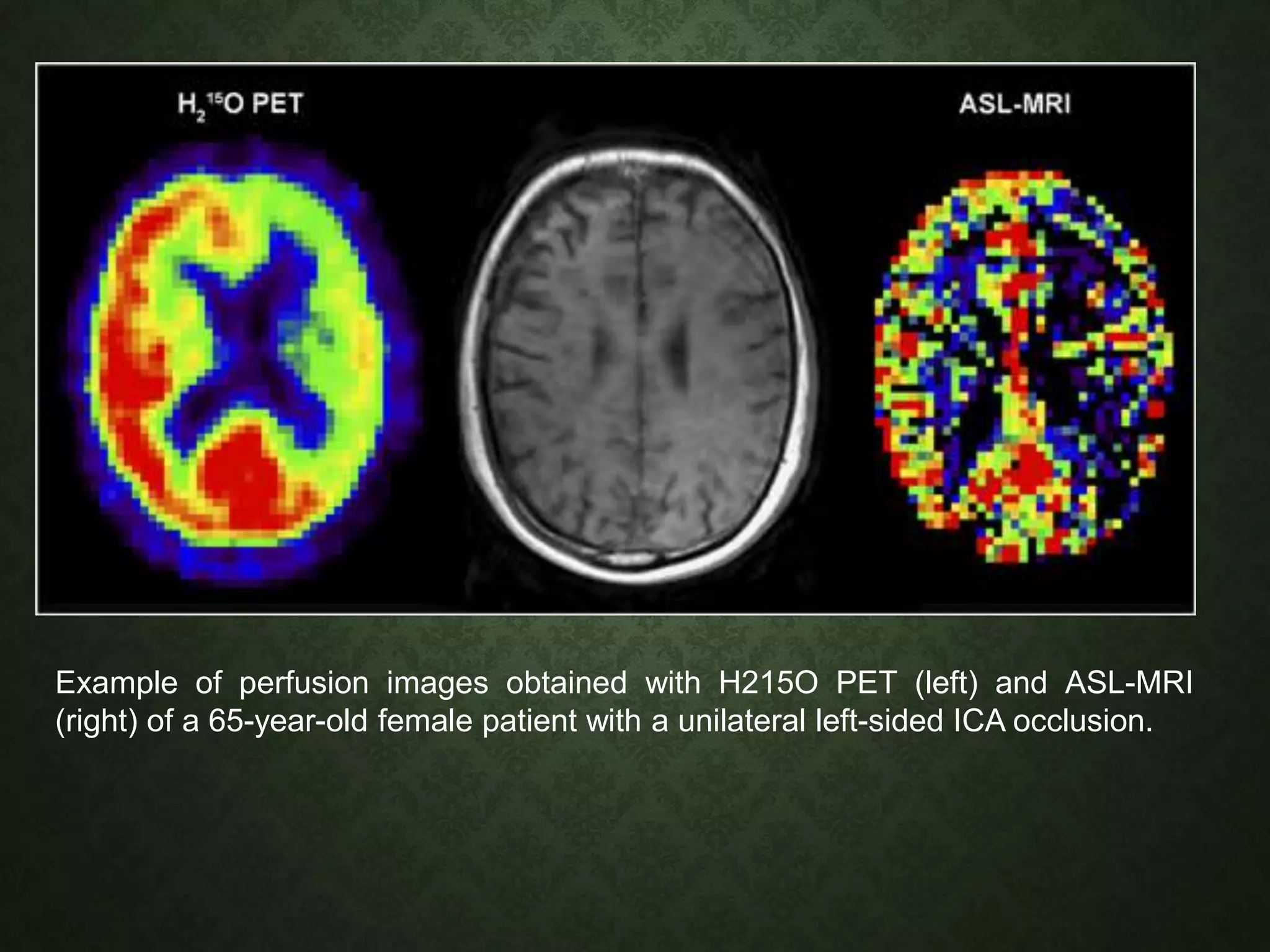 Measurement of Cerebral Blood Flow | PPTX | Medical Tests | Medical Health