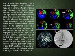 Measurement of Cerebral Blood Flow | PPTX