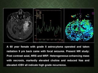 Measurement of Cerebral Blood Flow | PPTX