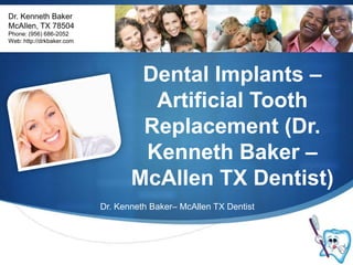 Dr. Kenneth Baker McAllen, TX 78504 Phone: (956) 686-2052 Web: http://drkbaker.com Dental Implants – Artificial Tooth Replacement (Dr. Kenneth Baker – McAllen TX Dentist) Dr. Kenneth Baker– McAllen TX Dentist 