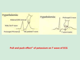 Pull and push effect” of potassium on T wave of ECG
 