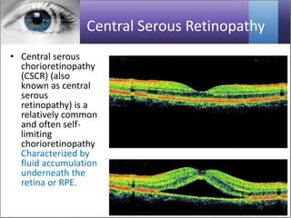 Optical/ocular coherence tomography OCT All in one Presentation | PPTX