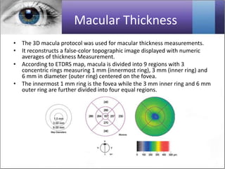Optical/ocular coherence tomography OCT All in one Presentation | PPTX