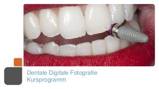 Dentale Digitale Fotografie
Kursprogramm
 