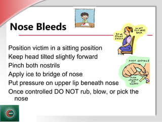 © Business & Legal Reports, Inc. 1110
Nose Bleeds
Position victim in a sitting position
Keep head tilted slightly forward
Pinch both nostrils
Apply ice to bridge of nose
Put pressure on upper lip beneath nose
Once controlled DO NOT rub, blow, or pick the
nosenose
 