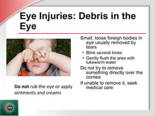 © Business & Legal Reports, Inc. 1110
Eye Injuries: Debris in the
Eye
Small, loose foreign bodies in
eye usually removed by
tears
• Blink several times
• Gently flush the area with
lukewarm water
Do not try to remove
something directly over the
cornea
If unable to remove it, seek
medical careDo not rub the eye or apply
ointments and creams
 