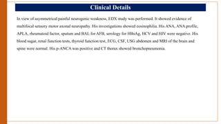 Clinical Details
In view of asymmetrical painful neurogenic weakness, EDX study was performed. It showed evidence of
multifocal sensory motor axonal neuropathy. His investigations showed eosinophilia. His ANA, ANA profile,
APLA, rheumatoid factor, sputum and BAL for AFB, serology for HBsAg, HCV and HIV were negative. His
blood sugar, renal function tests, thyroid function test, ECG, CSF, USG abdomen and MRI of the brain and
spine were normal. His p-ANCA was positive and CT thorax showed bronchopneumonia.
 