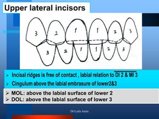 Upper lateral incisors
 MOL: above the labial surface of lower 2
 DOL: above the labial surface of lower 3
DrLaila Amin
 