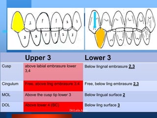 Lower 3Upper 3
Below lingnal embrasure 2,3above labial embrasure lower
3,4
Cusp
Free, below ling embrasure 2,3Free, above ling embrasure 3,4Cingulum
Below lingual surface 2Above the cusp tip lower 3MOL
Below ling surface 3Above lower 4 (BC)DOL
DrLaila Amin
 