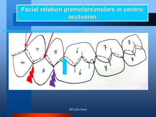 Facial relation premolarsmolars in centric
occlusion
DrLaila Amin
 
