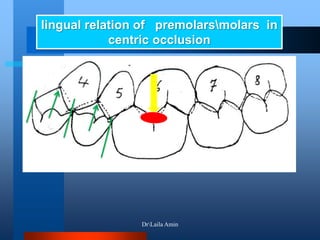 lingual relation of premolarsmolars in
centric occlusion
DrLaila Amin
 