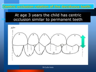 Centric occlusion relation of the deciduous teeth:
At age 3 years the child has centric
occlusion similar to permanent teeth
DrLaila Amin
 
