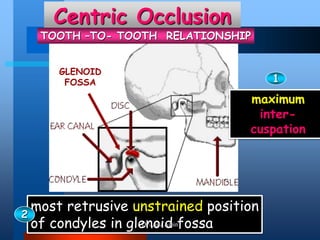Centric Occlusion
maximum
inter-
cuspation
most retrusive unstrained position
of condyles in glenoid fossa
GLENOID
FOSSA
TOOTH –TO- TOOTH RELATIONSHIP
1
DrLaila Amin
 