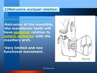 •Retrusion of the mandible,
•the mandibular teeth will
have posterior relation to
centric occlusion with the
maxillary arch.
•Very limited and non
functional movement.
2)Retrusive occlusal relation:
DrLaila Amin
 