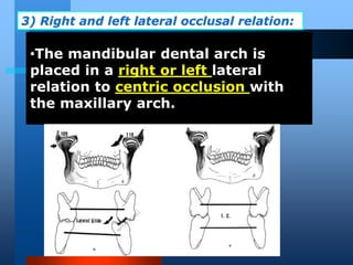 •The mandibular dental arch is
placed in a right or left lateral
relation to centric occlusion with
the maxillary arch.
3) Right and left lateral occlusal relation:
DrLaila Amin
 