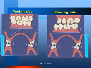 Working side Balancing side
DrLaila Amin
 