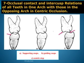7-Occlusal contact and intercusp Relations
of all Teeth in One Arch with those in the
Opposing Arch in Centric Occlusion.
a
b
c
a) Supporting cusps. b) guiding cusps
c) centric stop
DrLaila Amin
 