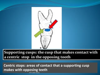 Supporting cusps: the cusp that makes contact with
a centric stop in the opposing tooth
Centric stops: areas of contact that a supporting cusp
makes with opposing teeth
DrLaila Amin
 