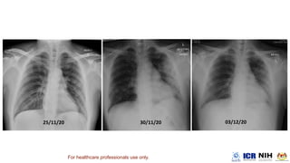 For healthcare professionals use only.
 