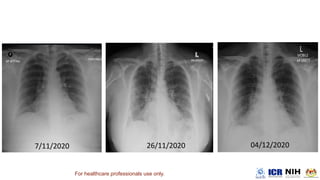 For healthcare professionals use only.
 