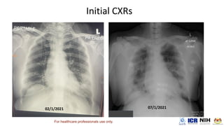 For healthcare professionals use only.
 