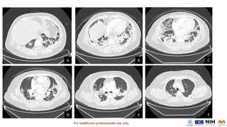 For healthcare professionals use only.
 