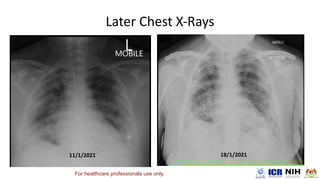 For healthcare professionals use only.
 