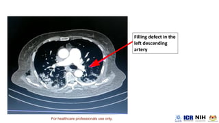 For healthcare professionals use only.
 