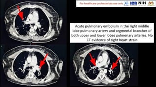 For healthcare professionals use only.
 