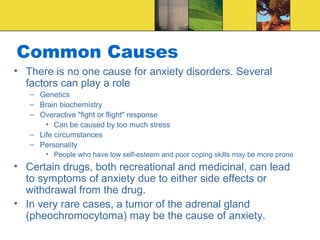 Common Causes
• There is no one cause for anxiety disorders. Several
  factors can play a role
   – Genetics
   – Brain biochemistry
   – Overactive "fight or flight" response
       • Can be caused by too much stress
   – Life circumstances
   – Personality
       • People who have low self-esteem and poor coping skills may be more prone
• Certain drugs, both recreational and medicinal, can lead
  to symptoms of anxiety due to either side effects or
  withdrawal from the drug.
• In very rare cases, a tumor of the adrenal gland
  (pheochromocytoma) may be the cause of anxiety.
 