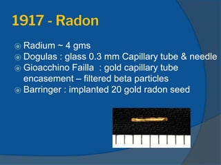 1917 - Radon
⦿ Radium ~ 4 gms
⦿ Dogulas : glass 0.3 mm Capillary tube & needle
⦿ Gioacchino Failla : gold capillary tube
encasement – filtered beta particles
⦿ Barringer : implanted 20 gold radon seed
 